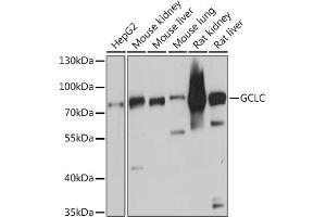 Western blot analysis of extracts of various cell lines, using GCLC antibody (ABIN6130444, ABIN6141016, ABIN6141017 and ABIN6214615) at 1:3000 dilution. (GCLC anticorps  (AA 1-252))