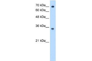 WB Suggested Anti-FCGRT Antibody Titration:  0. (FcRn anticorps  (N-Term))