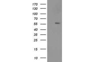 Western Blotting (WB) image for anti-Tumor Protein P53 (TP53) antibody (ABIN1499972)