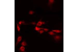 anti-C/EBP delta/epsilon antibody