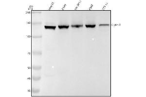 Western blot analysis of Lipin-1 using anti-Lipin-1 antibody (ABIN7605432).