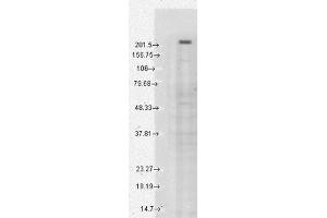 TRPM7 Western Blot. (TRPM7 anticorps  (C-Term))