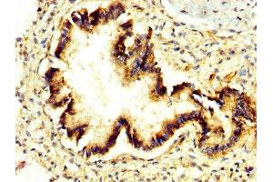 anti-Exopolyphosphatase PRUNE1 (PRUNE1) (AA 1-168) antibody