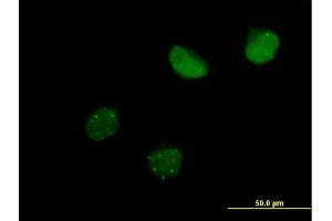Immunofluorescence of purified MaxPab antibody to SUMO4 on HeLa cell.