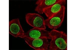 Fluorescent image of A549 cell stained with SUMO-1 antibody at 1:25. (SUMO1 anticorps  (AA 1-30))
