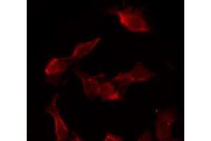 anti-Cystatin C (CST3) antibody