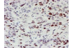 Image no. 1 for anti-Myeloid Leukemia Factor 1 (MLF1) antibody (ABIN1499495) (MLF1 anticorps)