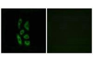 Immunofluorescence analysis of A549 cells, using ACOT12 antibody.