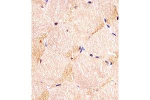(ABIN6243592 and ABIN6578121) staining ITGA7 in human skeletal muscle sections by Immunohistochemistry (IHC-P - paraformaldehyde-fixed, paraffin-embedded sections).