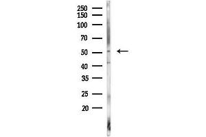 Western blot analysis of lysates from 293 cells, using Cytokeratin 7 Antibody at 1/1000 dilution.