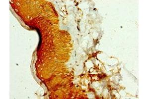 Immunohistochemistry of paraffin-embedded human skin tissue using ABIN7169410 at dilution of 1:100 (SMYD4 anticorps  (AA 1-260))