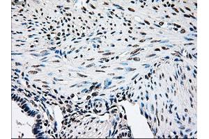 Immunohistochemical staining of paraffin-embedded pancreas tissue using anti-BRAFmouse monoclonal antibody. (BRAF anticorps)