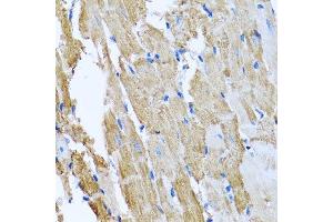Immunohistochemistry of paraffin-embedded rat heart using CCM2 antibody.