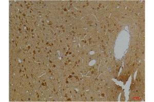 Immunohistochemistry (IHC) analysis of paraffin-embedded Rat Brain Tissue using Kv10.