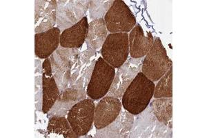 Immunohistochemical staining of human skeletal muscle with ANKRD2 polyclonal antibody  shows strong cytoplasmic positivity in myocytes at 1:500-1:1000 dilution. (ANKRD2 anticorps)