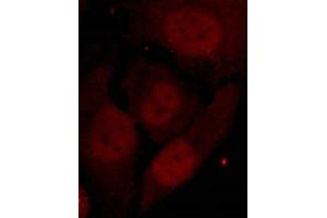 Immunofluorescence staining of methanol-fixed Hela cells showing nuclear staining using HDAC2(Phospho-Ser394) Antibody. (HDAC2 anticorps  (pSer394))
