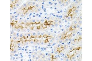 Immunohistochemistry of paraffin-embedded Mouse kidney using IL17A Polyclonal Antibody at dilution of 1:100 (40x lens).
