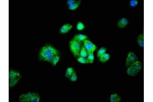 Immunofluorescence staining of HepG2 cells with ABIN7143641 at 1:66, counter-stained with DAPI.