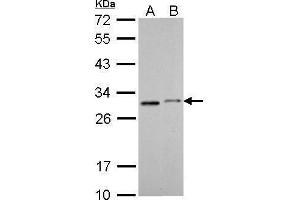WB Image SDHB antibody [C2C3], C-term detects SDHB protein by Western blot analysis. (SDHB anticorps  (C-Term))