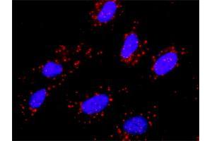 Proximity Ligation Analysis of protein-protein interactions between CBL and MET.