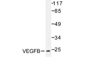 Image no. 1 for anti-Vascular Endothelial Growth Factor B (VEGFB) antibody (ABIN271976) (VEGFB anticorps)