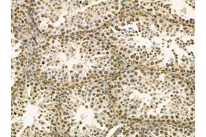 CAMKK1 Mouse Monoclonal Antibody at 1/100 staining mouse testis tissue by IHC-P. (CAMKK1 anticorps  (C-Term))