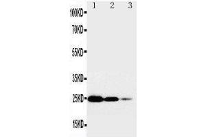 Anti-TNF Receptor I antibody, Western blotting Lane 1: Recombinant Human TNFR1 Protein 10ng Lane 2: Recombinant Human TNFR1 Protein 5ng Lane 3: Recombinant Human TNFR1 Protein 2. (TNFRSF1A anticorps  (Middle Region))