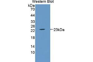 Detection of Recombinant LCN5, Mouse using Polyclonal Antibody to Lipocalin 5 (LCN5)