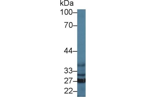 SFXN1 anticorps  (AA 2-102)
