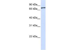 WB Suggested Anti-UNC5A Antibody Titration:  0. (UNC5A anticorps  (Middle Region))