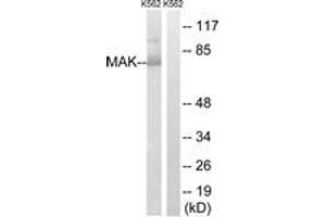 Western blot analysis of extracts from K562 cells, using MAK (Ab-159) Antibody. (MAK anticorps  (AA 126-175))