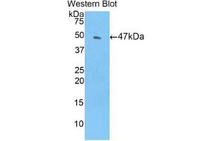 Western blot analysis of the recombinant protein. (TIMP4 anticorps  (AA 10-170))