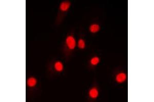Immunofluorescent analysis of NF-kappaB p100 (pS865) staining in HepG2 cells. (NFKB2 anticorps  (C-Term, pSer865))