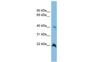 WB Suggested Anti-TGDS Antibody Titration: 0. (TGDS anticorps  (Middle Region))