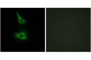 Immunofluorescence analysis of HeLa cells, using CDH17 Antibody.
