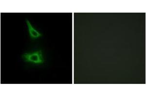 Immunofluorescence analysis of HeLa cells, using CDH17 Antibody. (LI Cadherin anticorps  (AA 341-390))