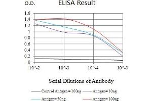 Black line: Control Antigen (100 ng),Purple line: Antigen (10 ng), Blue line: Antigen (50 ng), Red line:Antigen (100 ng)