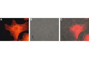 Expression of MC1R in human Malme-3M cells - Immunocytochemical staining of human paraformaldehyde fixed and permeabilized malignant melanoma cell lines (Malme-3M).
