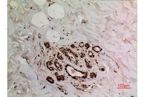 Immunohistochemistry (IHC) analysis of paraffin-embedded Human Breast, antibody was diluted at 1:100. (XRCC6 anticorps  (acLys539))