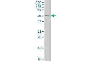 WARS monoclonal antibody (M02), clone 3A12 Western Blot analysis of WARS expression in HeLa .