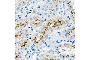 Immunohistochemical analysis of TGF beta 2 staining in human kidney formalin fixed paraffin embedded tissue section. (TGFB2 anticorps)