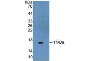 Detection of Recombinant DKK4, Human using Polyclonal Antibody to Dickkopf Related Protein 4 (DKK4)