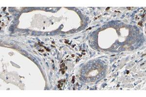 ABIN6277345 at 1/100 staining Human prostate tissue by IHC-P. (USO1 anticorps  (C-Term))