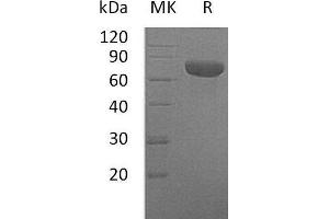 Western Blotting (WB) image for Cytokine Receptor-Like Factor 2 (CRLF2) protein (Fc Tag) (ABIN7320659)