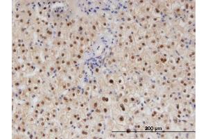 Immunoperoxidase of monoclonal antibody to RAD23B on formalin-fixed paraffin-embedded human liver. (RAD23B anticorps  (AA 311-409))