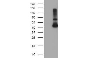 Western Blotting (WB) image for anti-Alcohol Dehydrogenase 7 (Class IV), mu Or sigma Polypeptide (ADH7) antibody (ABIN1496482)