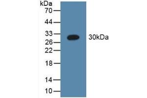 Detection of Recombinant C1qA, Human using Polyclonal Antibody to Complement Component 1, Q Subcomponent A (C1qA)