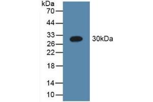 Detection of Recombinant C1qA, Human using Polyclonal Antibody to Complement Component 1, Q Subcomponent A (C1qA) (C1QA anticorps  (AA 28-245))