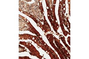 Immunohistochemical analysis of paraffin-embedded human duodenum tissue using (ABIN655597 and ABIN2845082) performed on the Leica® BOND RXm. (ADA anticorps  (C-Term))