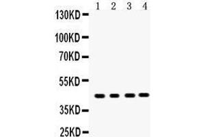SERPINB5 anticorps  (AA 1-350)
